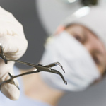 Chirurg szczękowy robi resekcję wierzchołka korzenia zęba w celu pokrywania recesji zębowych