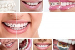 ortodoncja Wrocław najlepsza klinika najlepszy ortodonta tylko w AuriDent