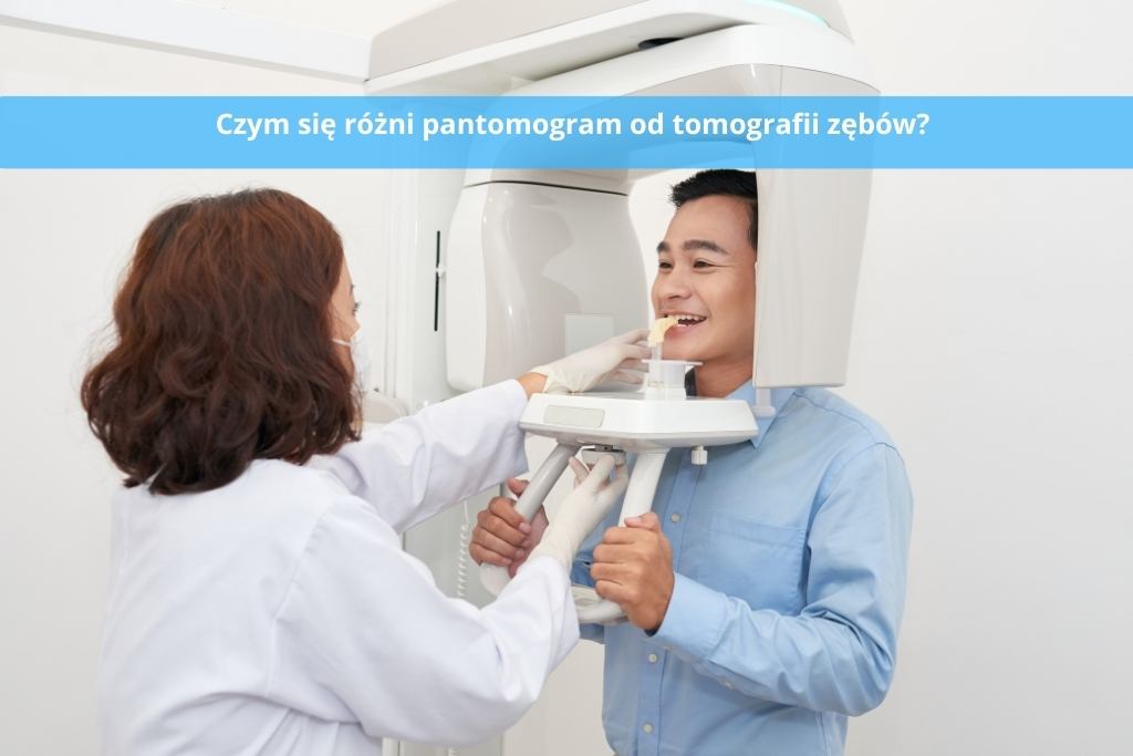 Czym się różni pantomogram od tomografii zębów?