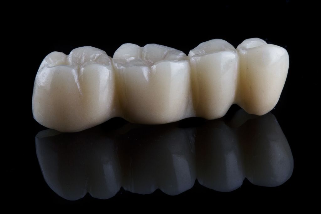 mostek porcelanowy 