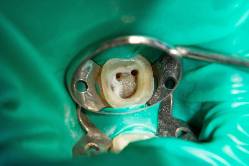 efekty leczenia stomatologicznego w klinice Aurident we Wrocławiu