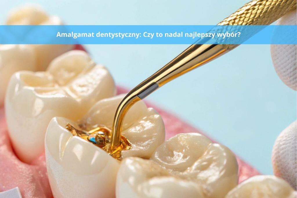 Amalgamat dentystyczny: Czy to nadal najlepszy wybór?